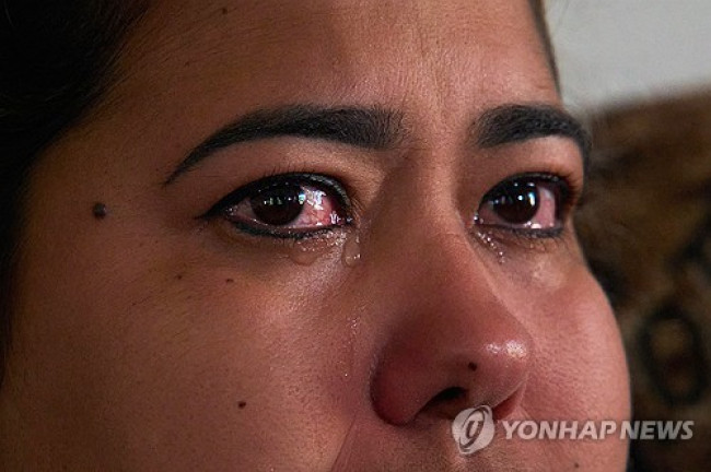 쿠바 여성이 인터뷰 도중 눈물을 흘리고 있다